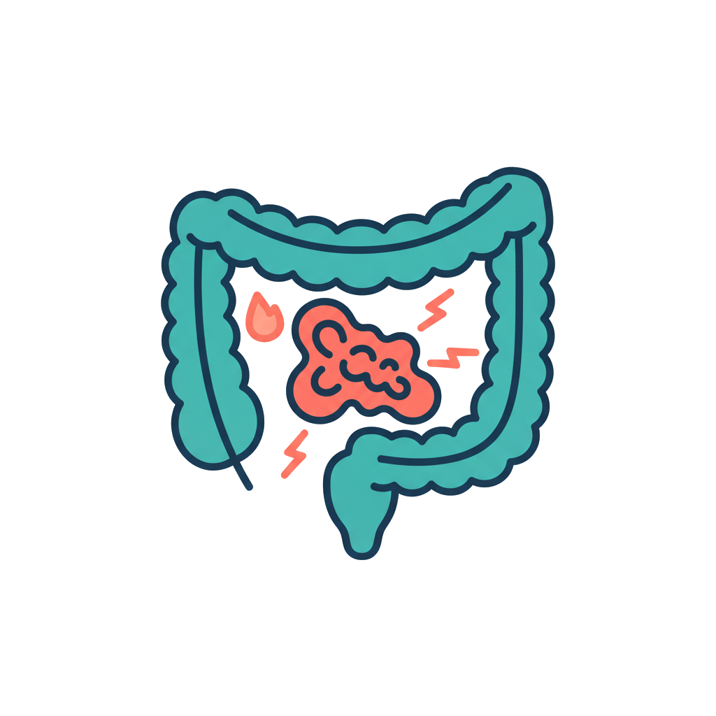 Colon cancer